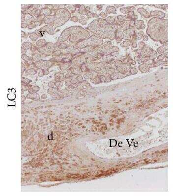 Immunohistochemistry: LC3 Antibody Pack [NB910-40435]