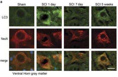 Immunohistochemistry: LC3 Antibody Pack [NB910-40752]
