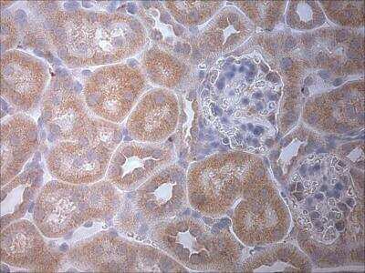 Immunohistochemistry: LC3 Antibody Pack [NB910-40752]