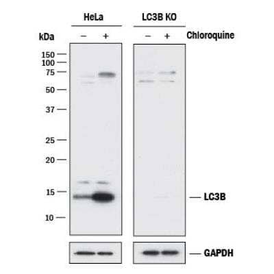Knockout Validated: LC3 Antibody Pack [NB910-40752]
