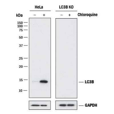Knockout Validated: LC3 Antibody Pack [NBP2-59703]