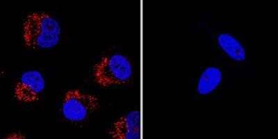 Knockout Validated: LC3 Antibody Pack [NBP2-59703]