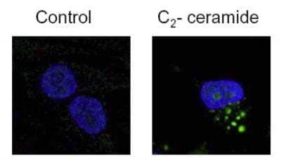Immunocytochemistry/ Immunofluorescence: LC3 Antibody Pack [NB910-40752]
