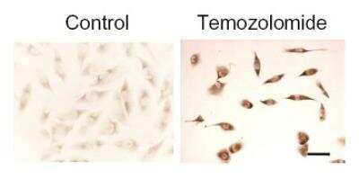 Immunohistochemistry: LC3 Antibody Pack [NB910-40752]