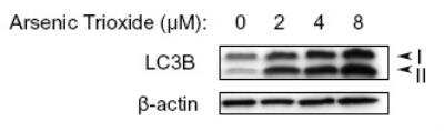 Western Blot: LC3 Antibody Pack [NB910-40752]