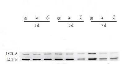 Western Blot: LC3A AntibodyAzide Free [NBP2-33254]