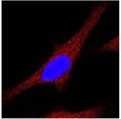 Immunocytochemistry/ Immunofluorescence: LC3A Antibody - BSA Free [NB100-2331]