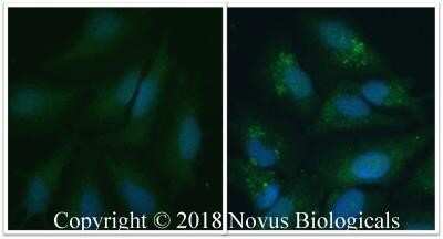 Immunocytochemistry/ Immunofluorescence: LC3A Antibody - BSA Free [NB100-2331]