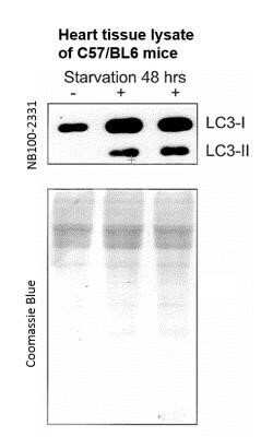 Western Blot: LC3A AntibodyBSA Free [NB100-2331]
