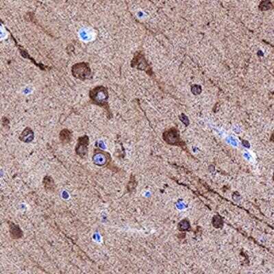 Immunohistochemistry-Paraffin: LC3A Antibody (2312D) - BSA Free [NBP2-75924]