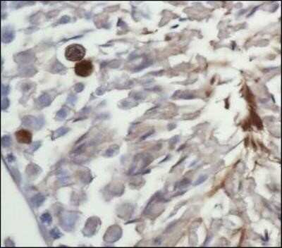 Immunohistochemistry: LC3A Antibody - BSA Free [NBP1-78964]