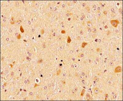 Immunohistochemistry-Paraffin: LC3A Antibody [NBP1-19167]