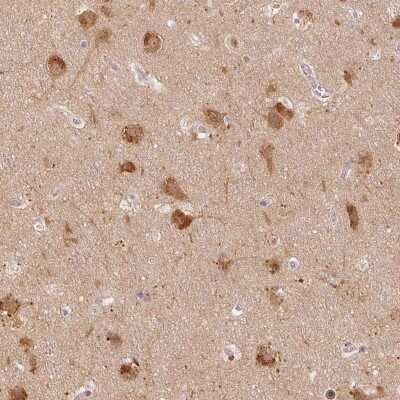 Immunohistochemistry-Paraffin: LC3A Antibody [NBP2-48512]