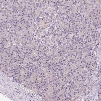 Immunohistochemistry-Paraffin: LC3A Antibody [NBP2-48512]
