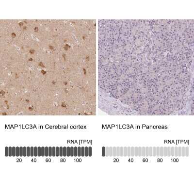 Immunohistochemistry-Paraffin: LC3A Antibody [NBP2-48512]