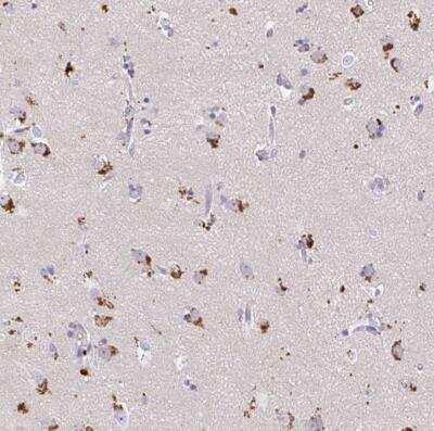 Immunohistochemistry-Paraffin: LC3A Antibody [NBP2-54740]