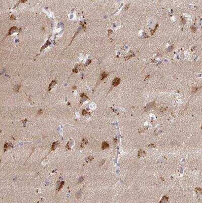 Immunohistochemistry-Paraffin: LC3A Antibody [NBP2-54741]