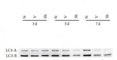 Western Blot: LC3A Antibody [NBP2-24394]