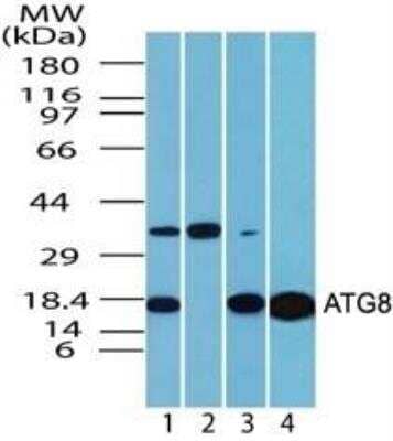 Western Blot: LC3A Antibody [NBP2-24394]