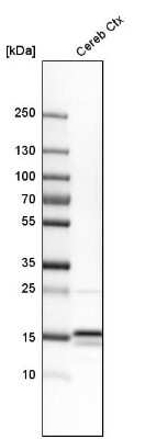 Western Blot: LC3A Antibody [NBP2-48512]