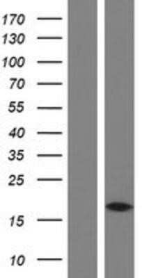 Western Blot: LC3A Overexpression Lysate [NBP2-04906]