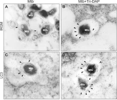 Detection of LC3B in Infected Human Alveolar Macrophages Using Electron Microscopy