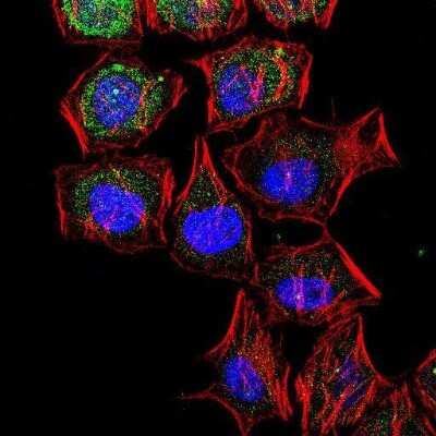 Immunocytochemistry/Immunofluorescence Detection of LC3B in HeLa Cells