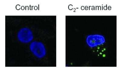 Staining of LC3B in Treated U373-MG Cells Using HRP Conjugated LC3B Antibody