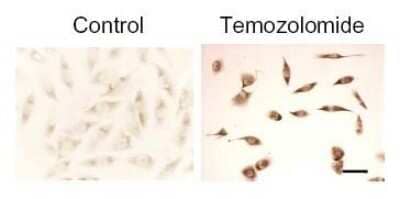 Immunocytochemical Staining of LC3B in Treated U373-MG Cells