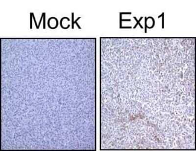 Immunohistochemical Staining of LC3B in Paraffin Embedded U87MG Glioma Xenografts