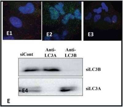 Knockdown Validation of LC3B Antibody in Multiple Applications