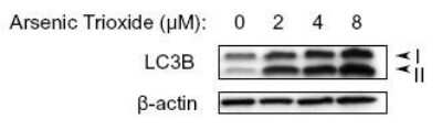 Western Blot Analysis of LC3B in Treated U87-MG Lysates