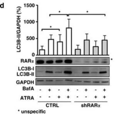 Western Blotting of LC3B in Treated Control and RARalpha-Knockdown SKBR3 Cells