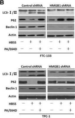 Western Blot Detection of LC3B in Transfected FTC-133 and TPC-1 Cells with Various Treatments