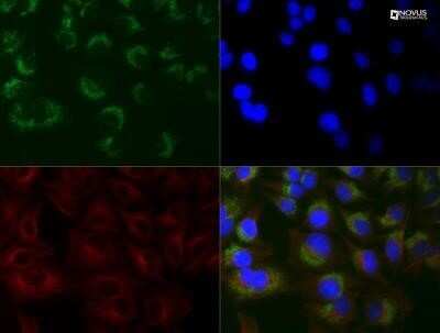 Immunocytochemistry/ Immunofluorescence: LC3B Antibody (1251A) - Azide and BSA Free [NBP2-80829]