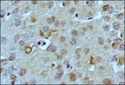Immunohistochemistry-Paraffin: LC3B Antibody (1251A) - Azide and BSA Free [NBP2-80829]