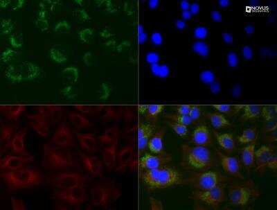 Immunocytochemistry/ Immunofluorescence: LC3B Antibody (1251A) - BSA Free [NBP2-46892]