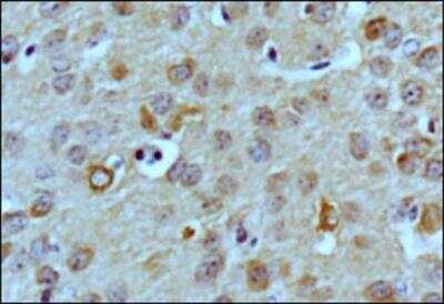 Immunohistochemistry-Paraffin: LC3B Antibody (1251A) - BSA Free [NBP2-46892]