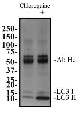 Immunoprecipitation: LC3B Antibody (1251A) - BSA Free [NBP2-46892]