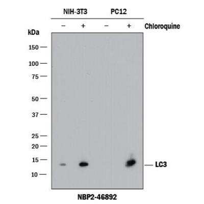 Western Blot: LC3B Antibody (1251A)BSA Free [NBP2-46892]