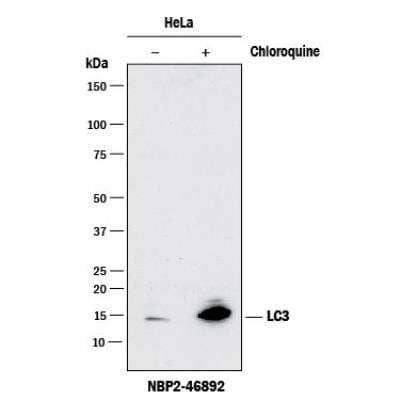 Western Blot: LC3B Antibody (1251A)BSA Free [NBP2-46892]