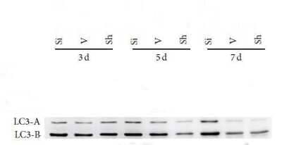 Western Blot: LC3B Antibody (1251A)BSA Free [NBP2-46892]