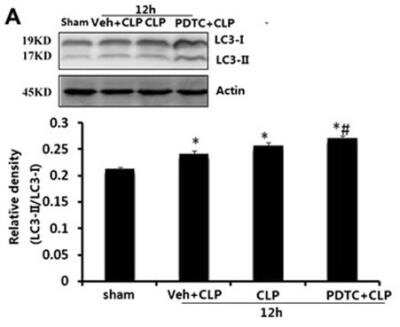 Western Blot: LC3B Antibody (1251A)BSA Free [NBP2-46892]