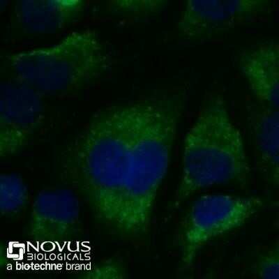 Immunocytochemistry/ Immunofluorescence: LC3B Antibody (1251B) - Azide and BSA Free [NBP2-80831]