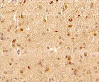 Immunohistochemistry: LC3B Antibody (1251B) - Azide and BSA Free [NBP2-80831]