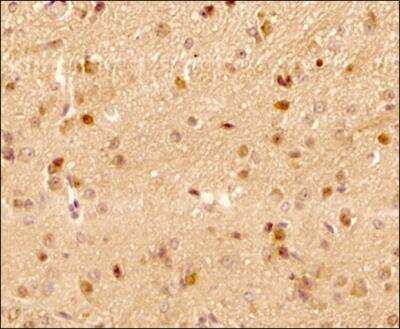 Immunohistochemistry-Paraffin: LC3B Antibody (1251B) - BSA Free [NBP2-60735]
