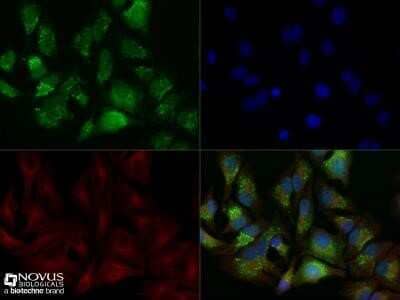 Immunocytochemistry/ Immunofluorescence: LC3B Antibody (1251D) - Azide and BSA Free [NBP2-80830]