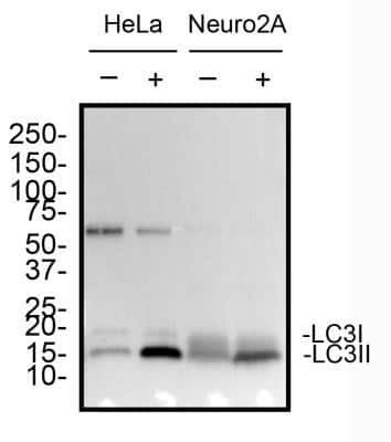 Western Blot: LC3B Antibody (1251D)Azide and BSA Free [NBP2-80830]