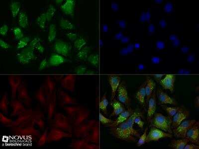 Immunocytochemistry/ Immunofluorescence: LC3B Antibody (1251D) - BSA Free [NBP2-59800]