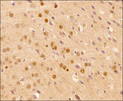 Immunohistochemistry-Paraffin: LC3B Antibody (1251D) - BSA Free [NBP2-59800]